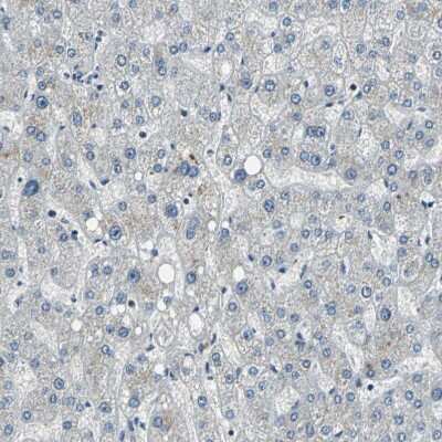 Immunohistochemistry-Paraffin: RBM14 Antibody [NBP1-84416]