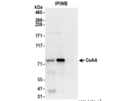 Immunoprecipitation: RBM14 Antibody [NB100-2884]