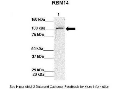 Western Blot: RBM14 Antibody [NBP1-80243]