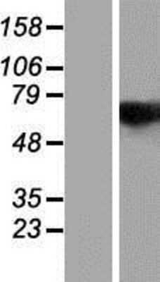 Western Blot: RBM14 Overexpression Lysate [NBP2-07626]