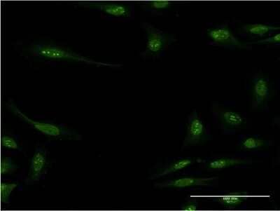 Immunocytochemistry/ Immunofluorescence: RBM15 Antibody (3E2) [H00064783-M07]