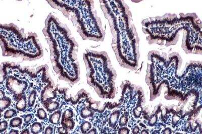 Immunohistochemistry-Paraffin: RBM15 Antibody [NBP1-31364]