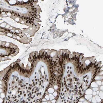 Immunohistochemistry-Paraffin: RBM15 Antibody [NBP1-82465]
