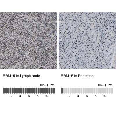 Immunohistochemistry-Paraffin: RBM15 Antibody [NBP1-82465]