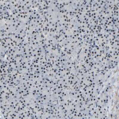 Immunohistochemistry-Paraffin: RBM15 Antibody [NBP1-82465]