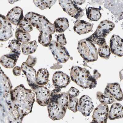 Immunohistochemistry-Paraffin: RBM15 Antibody [NBP1-82465]