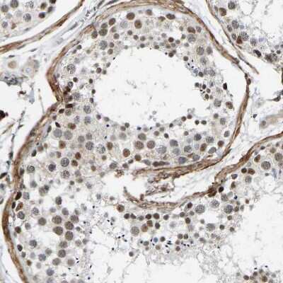 Immunohistochemistry-Paraffin: RBM15 Antibody [NBP1-82465]