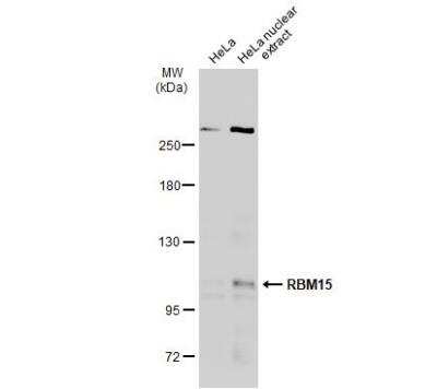 Western Blot: RBM15 Antibody [NBP1-31364]