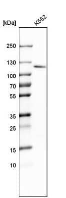 Western Blot: RBM15 Antibody [NBP1-82465]