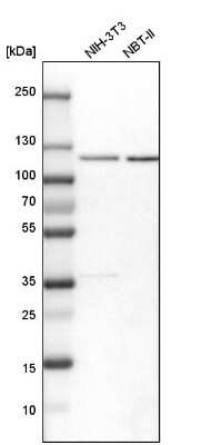 Western Blot: RBM15 Antibody [NBP1-82465]