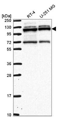 Western Blot: RBM15 Antibody [NBP2-56787]