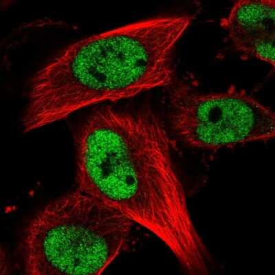 Immunocytochemistry/ Immunofluorescence: RBM15B Antibody [NBP2-58773]