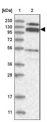 Western Blot: RBM15B Antibody [NBP1-81650]