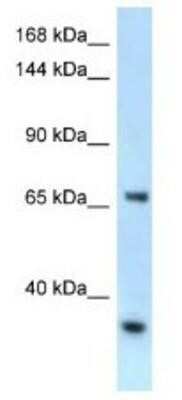 Western Blot: RBM15B Antibody [NBP1-82412]