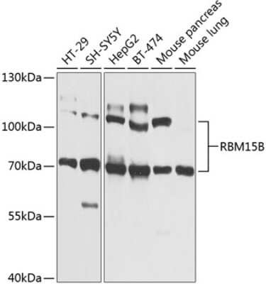 Western Blot: RBM15B AntibodyBSA Free [NBP2-93507]