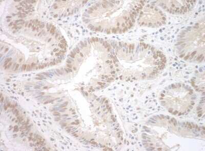Immunohistochemistry: RBM17 Antibody [NBP1-80576]