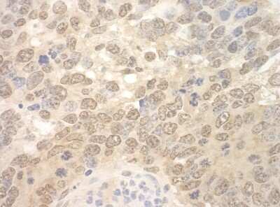 Immunohistochemistry: RBM17 Antibody [NBP1-80576]