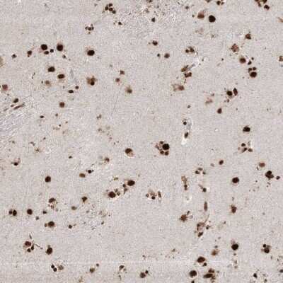 Immunohistochemistry: RBM17 Antibody [NBP2-38348]