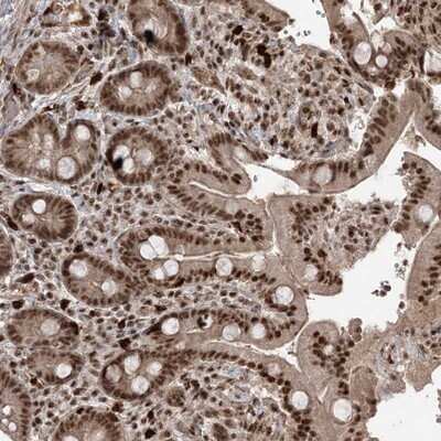 Immunohistochemistry-Paraffin: RBM17 Antibody [NBP1-81202]