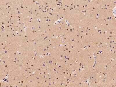 Immunohistochemistry-Paraffin: RBM17 Antibody [NBP2-97616]