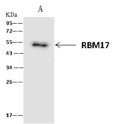 Immunoprecipitation: RBM17 Antibody [NBP2-97616]