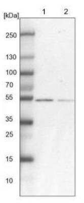 Western Blot: RBM17 Antibody [NBP1-81202]