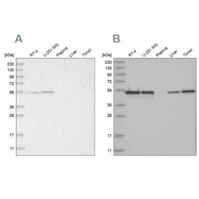 Western Blot: RBM17 Antibody [NBP1-81202]