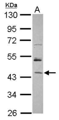 Western Blot: RBM17 Antibody [NBP2-20103]