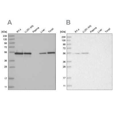 Western Blot: RBM17 Antibody [NBP2-38348]