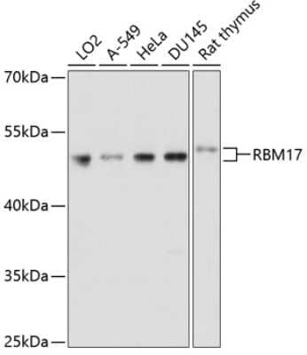 Western Blot: RBM17 AntibodyBSA Free [NBP2-94654]