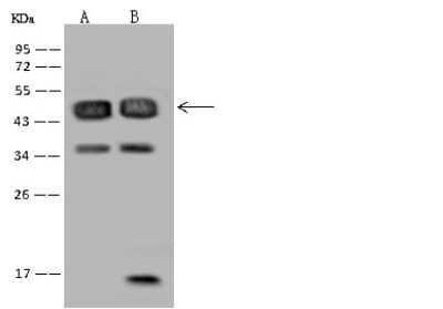 Western Blot: RBM17 Antibody [NBP2-97616]