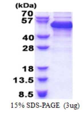 SDS-PAGE: Recombinant Human RBM17 His Protein [NBP2-23445]