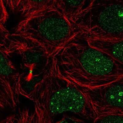 Immunocytochemistry/ Immunofluorescence: RBM18 Antibody [NBP2-31670]