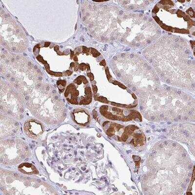 Immunohistochemistry-Paraffin: RBM18 Antibody [NBP2-31670]