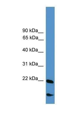 Western Blot: RBM18 Antibody [NBP1-80471]