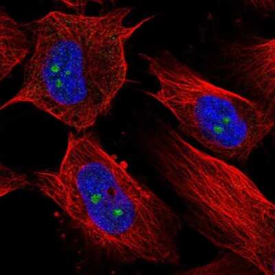 Immunocytochemistry/ Immunofluorescence: RBM19 Antibody [NBP2-55043]