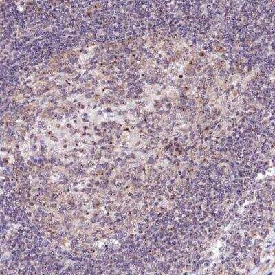 Immunohistochemistry: RBM19 Antibody [NBP1-84135]