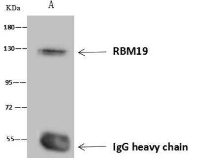 Immunoprecipitation: RBM19 Antibody [NBP3-12591]