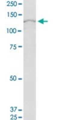 Western Blot: RBM19 Antibody [H00009904-B01P]