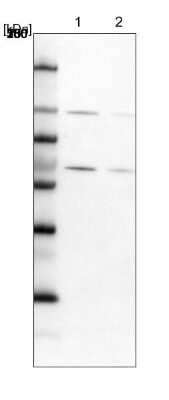 Western Blot: RBM19 Antibody [NBP1-84135]