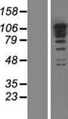 Western Blot: RBM19 Overexpression Lysate [NBP2-07074]