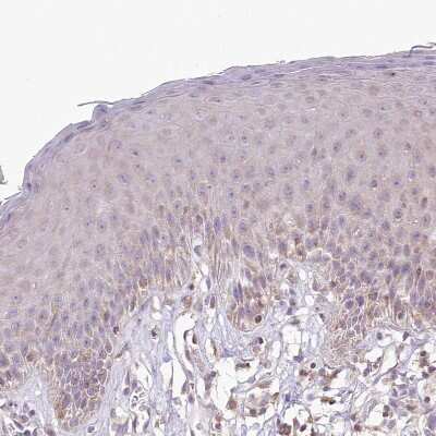 Immunohistochemistry-Paraffin: RBM20 Antibody [NBP2-34038]