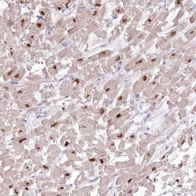 Immunohistochemistry-Paraffin: RBM20 Antibody [NBP2-34038]