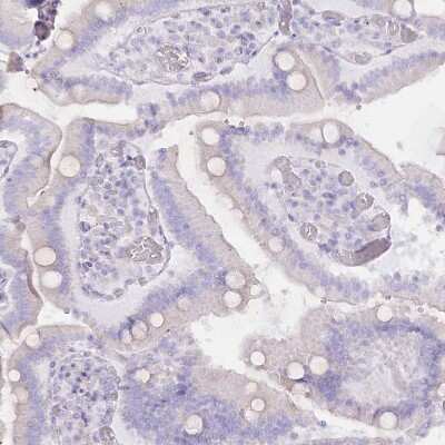 Immunohistochemistry-Paraffin: RBM20 Antibody [NBP2-34038]