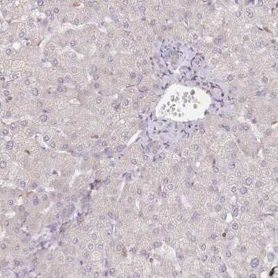 Immunohistochemistry-Paraffin: RBM20 Antibody [NBP2-34038]