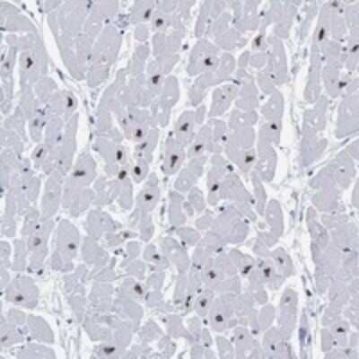 Immunohistochemistry-Paraffin: RBM20 Antibody [NBP3-17532]