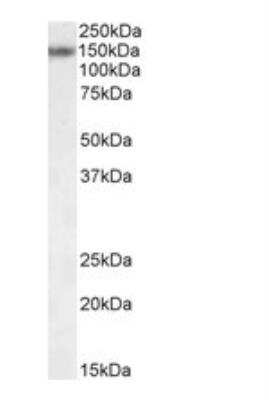 Western Blot: RBM20 Antibody [NBP2-27509]