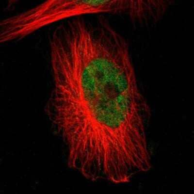 Immunocytochemistry/ Immunofluorescence: RBM22 Antibody [NBP1-85379]