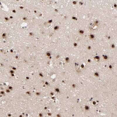 Immunohistochemistry-Paraffin: RBM22 Antibody [NBP1-85379]