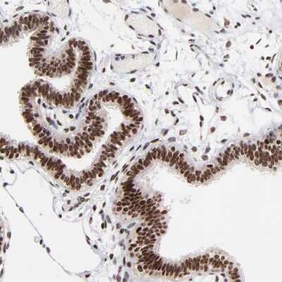 Immunohistochemistry-Paraffin: RBM22 Antibody [NBP1-85379]